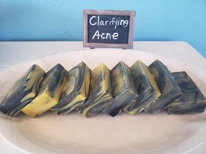 Clarifying Acne